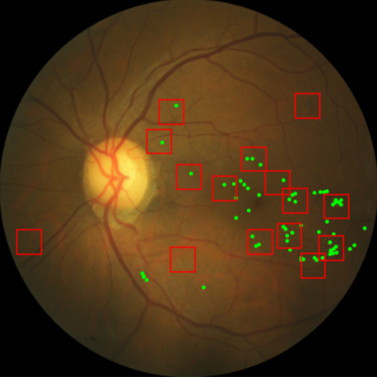 Machine Learning for Safe Medical Diagnostics