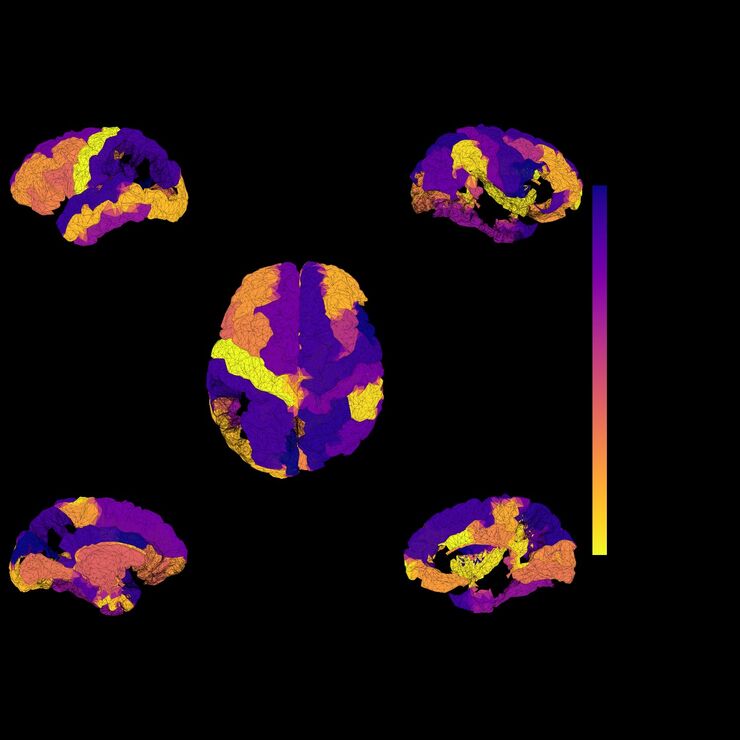 Computational Neuropsychiatry